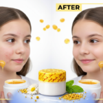 نتائج كريم العسل الملكي قبل وبعد